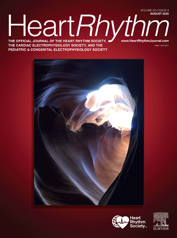 Heart Rhythm